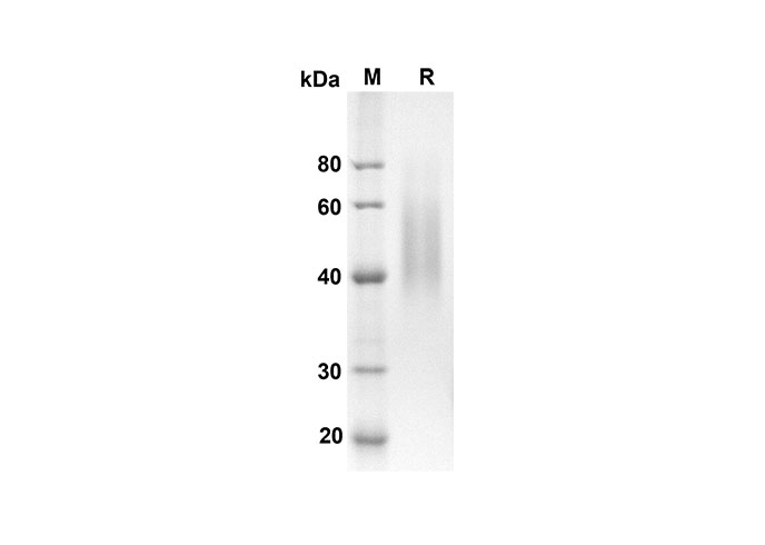Recombinant Human MCSF Protein(GST Tag)-产品推荐-1