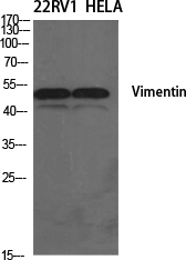 Western Blot analysis of 22RV1, Hela cells using Vimentin Polyclonal Antibody at dilution of 1:1000.