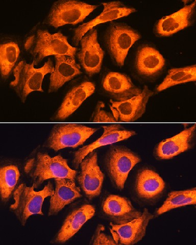 Immunofluorescence analysis of U20S cells using RIG-I / DDX58 Polyclonal Antibody at dilution of 1:100. Blue: DAPI for nuclear staining.