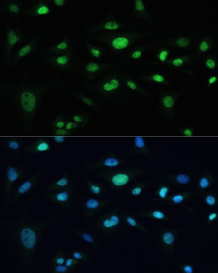 Immunofluorescence analysis of U-2 OS cells using MDC1 Polyclonal Antibody at dilution of  1:100. Blue: DAPI for nuclear staining.