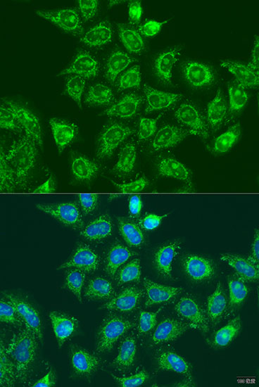 Immunofluorescence analysis of U2OS cells using UBE2A Polyclonal Antibody at dilution of 1:100. Blue: DAPI for nuclear staining.