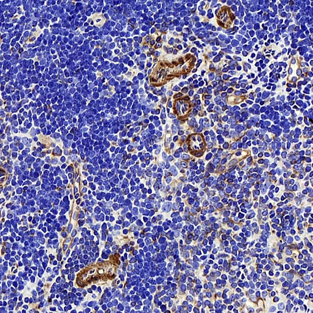 Immunohistochemistry analysis of paraffin-embedded mouse thymus  using LDLR Polyclonal Antibody at dilution of 1:300.