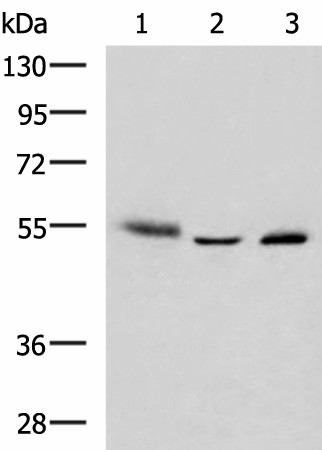 Western blot analysis of Human skin tissue A172 cell Human bladder transitional cell carcinoma grade 2-3 tissue lysates  using IKZF2 Polyclonal Antibody at dilution of 1:950