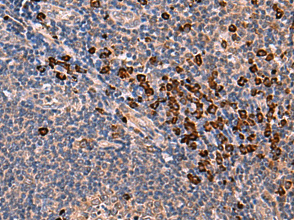 Immunohistochemistry of paraffin-embedded Human tonsil tissue  using INSM2 Polyclonal Antibody at dilution of 1:35(?200)