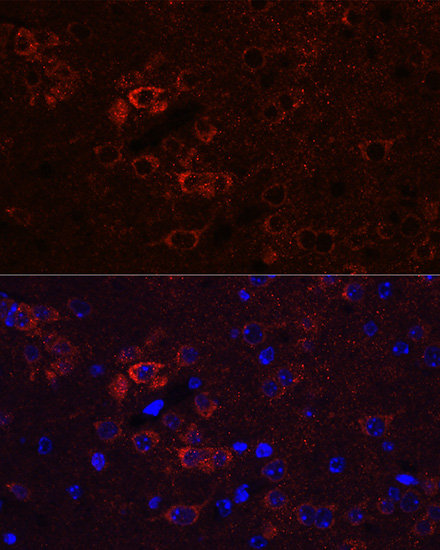 Immunofluorescence analysis of Mouse brain using ELAVL3 Polyclonal Antibody at dilution of  1:100 (40x lens). Blue: DAPI for nuclear staining.