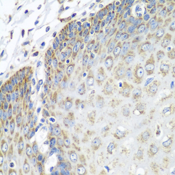 Immunohistochemistry of paraffin-embedded human esophagus using TMOD3 Polyclonal Antibody at dilution of 1:100 (40x lens).Perform microwave antigen retrieval with 10 mM PBS buffer pH 7.2 before commencing with IHC staining protocol.