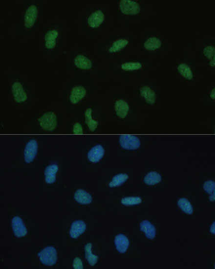 Immunofluorescence analysis of U-2 OS cells using MKL1 Polyclonal Antibody at dilution of  1:100 (40x lens). Blue: DAPI for nuclear staining.