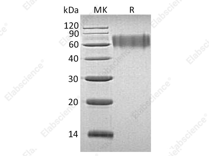 Recombinant Human LYPD3 Protein (His Tag) - 1