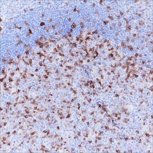 Recombinant CD278/ICOS Monoclonal Antibody - small - 2