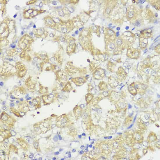 Immunohistochemistry of paraffin-embedded Human stomach using Bcl-2 Polyclonal Antibody at dilution of 1:100 (40x lens).