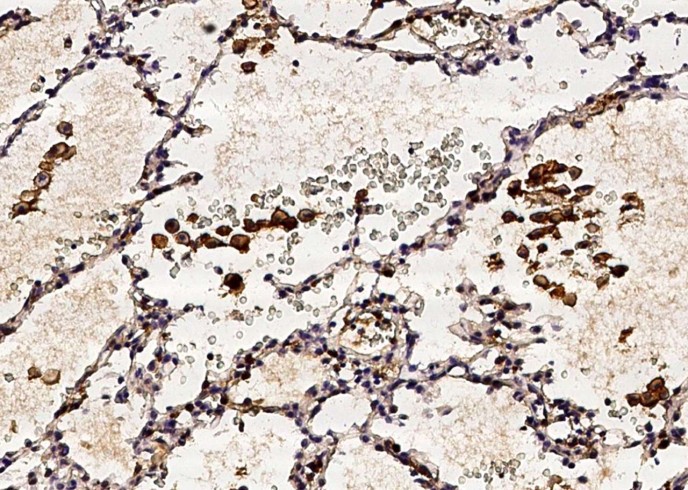 CD16a/FCGR3A Monoclonal Antibody - small - 2