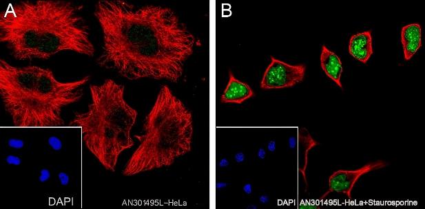 Recombinant Cleaved PARP1 p85 Monoclonal Antibody - 2