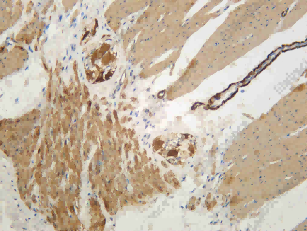 Recombinant Myosin Heavy Chain, Smooth Muscle (SMMHC) Monoclonal Antibody - 2