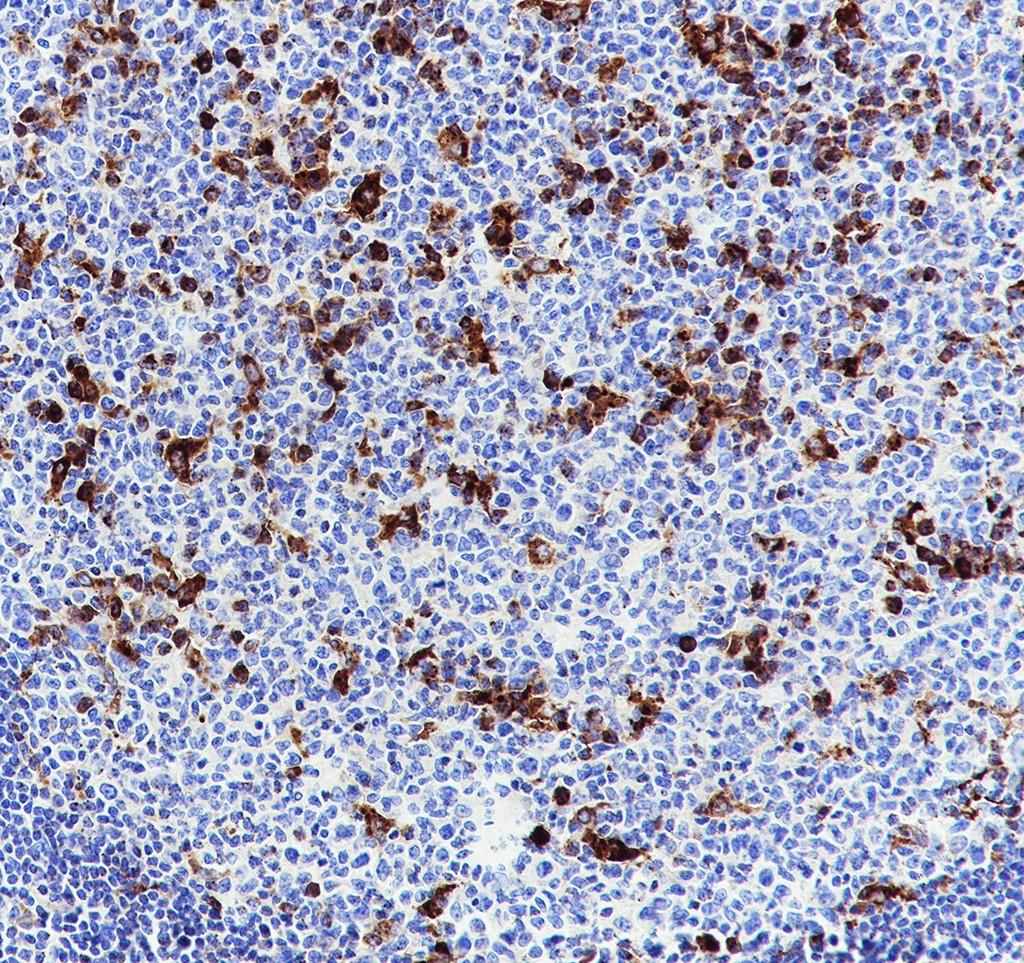 Recombinant ADA2 Monoclonal Antibody - 2