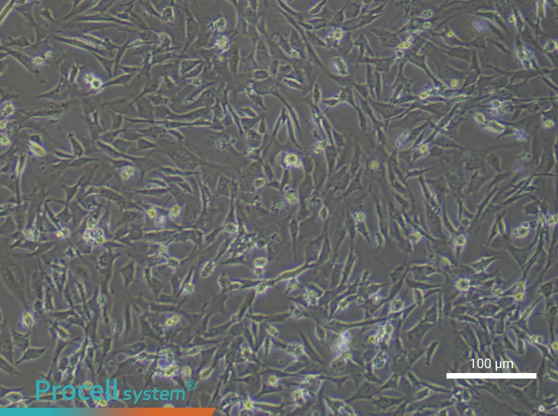 Mouse Hepatic Stellate Cells (Primary cell immortalization)Mouse Hepatic Stellate Cells (Primary cell immortalization) - 3
