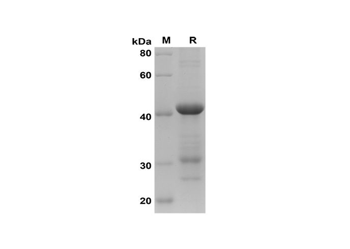 Recombinant Human TNF-α Protein(Gst Tag)-产品推荐-1