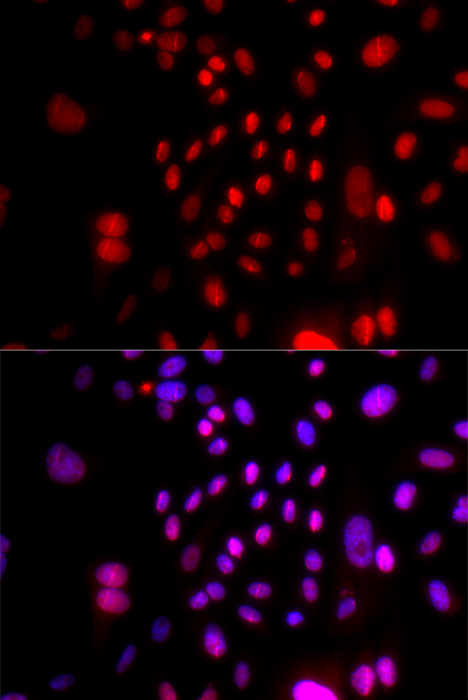 Immunofluorescence analysis of U2OS cells using RFC4 Polyclonal Antibody Blue: DAPI for nuclear staining.