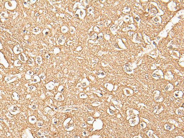 Immunohistochemistry of paraffin-embedded Human brain tissue  using ADORA3 Polyclonal Antibody at dilution of 1:30(?200)