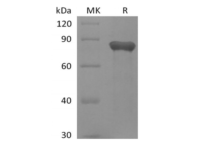 Immobilized Human AXL-His at 10ug/ml (100 ul/well) can bind Human GAS6-His : Biotinylated by NHS-biotin prior to testing. The ED50 of Recombinant Human GAS6-His is 0.04466 ug/ml.