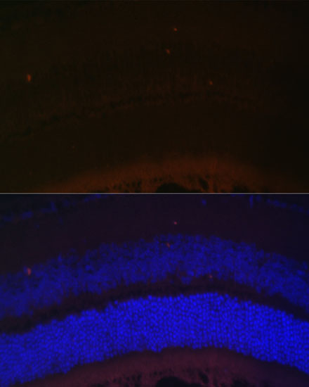 Immunofluorescence analysis of Mouse retina using RDH5 Polyclonal Antibody at dilution of 1:100 (40x lens). Blue: DAPI for nuclear staining.