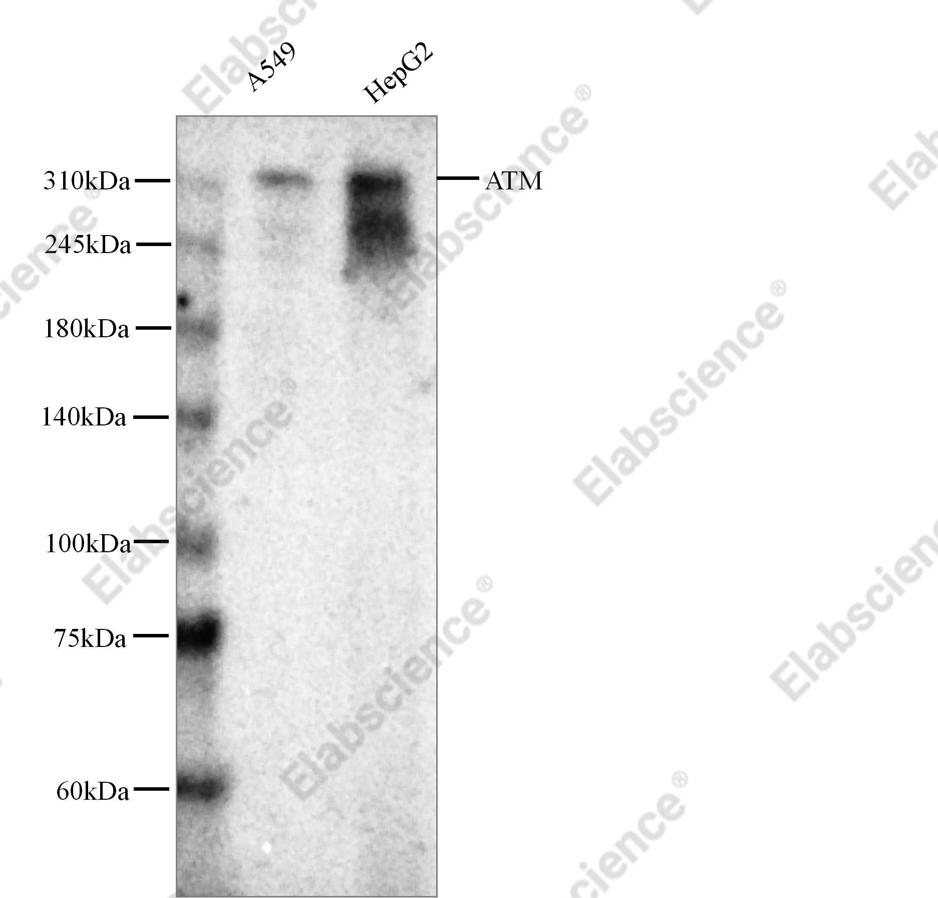 Recombinant ATM Monoclonal Antibody - 1