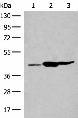 Western blot analysis of Mouse liver tissue Mouse kidney tissue Rat brain tissue lysates  using GPR22 Polyclonal Antibody at dilution of 1:500