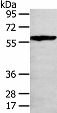 Western Blot analysis of 293T cell using THAP4 Polyclonal Antibody at dilution of 1/250