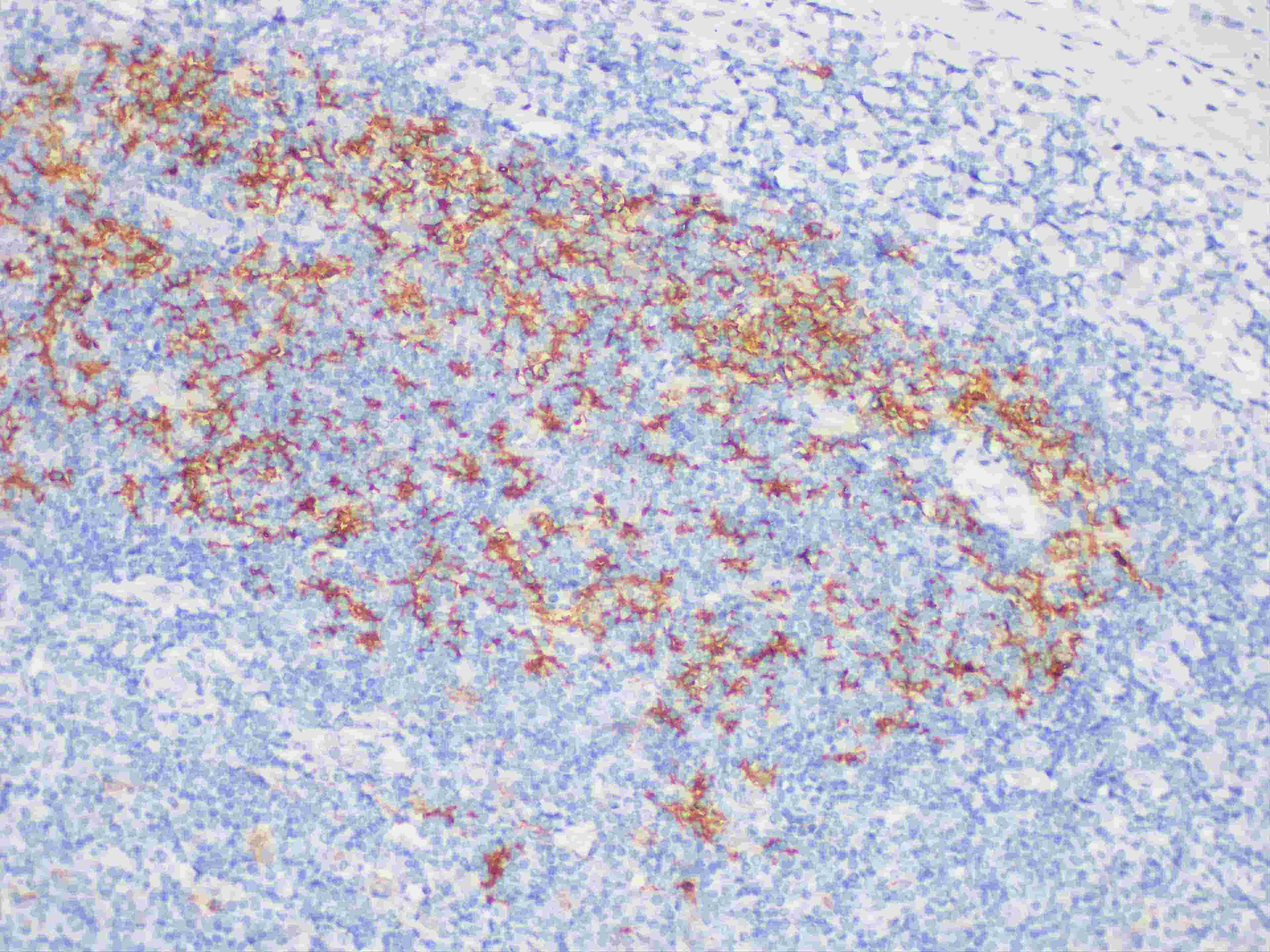 Immunohistochemistry of paraffinembedded Human tonsil tissue with Fascin Monoclonal Antibody(Antigen repaired by EDTA).