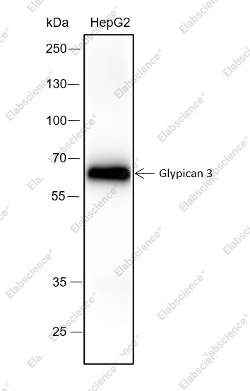 Recombinant Glypican 3 Monoclonal Antibody - 1