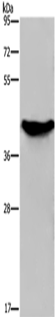 Western Blot analysis of Human fetal liver tissue using GALK1 Polyclonal Antibody at dilution of 1:450