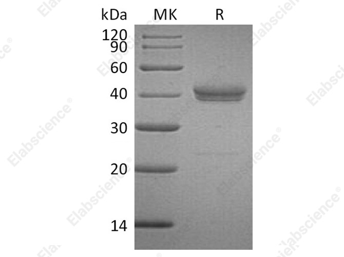 Recombinant Human CADM3 Protein (His Tag) - 1