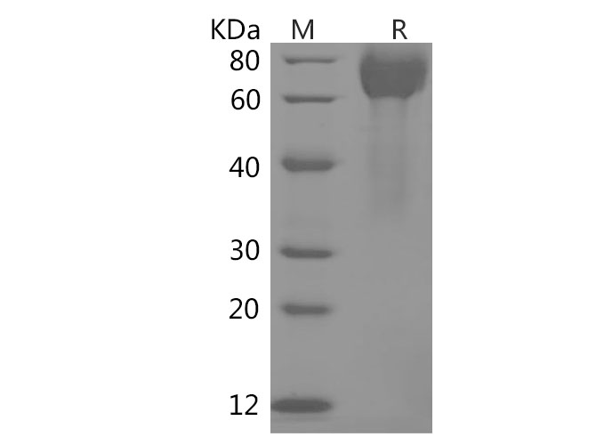 Recombinant Human SerpinE1/PAI-1 Protein (His Tag)-产品推荐-1
