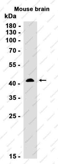 Recombinant Creatine kinase B type Monoclonal Antibody - 3