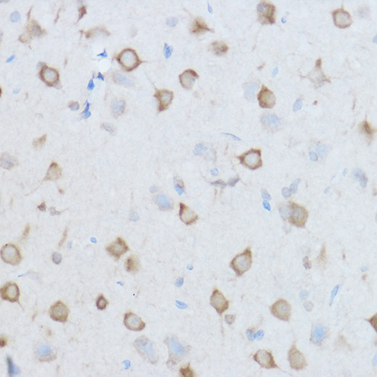 Immunohistochemistry of paraffin-embedded Mouse brain using CCT8 Polyclonal Antibody at dilution of 1:100 (40x lens).Perform high pressure antigen retrieval with 10 mM citrate buffer pH 6.0 before commencing with IHC staining protocol.