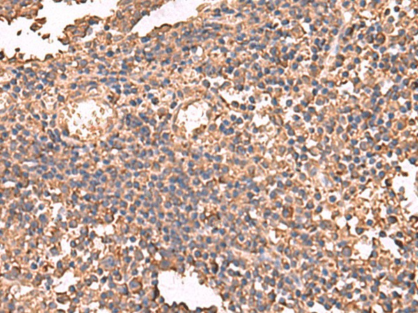 Immunohistochemistry of paraffin-embedded Human tonsil tissue  using LDHAL6B Polyclonal Antibody at dilution of 1:65(?200)