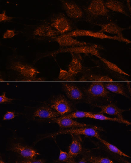 Immunofluorescence analysis of C6 cells using AP3S2 Polyclonal Antibody at dilution of 1:100. Blue: DAPI for nuclear staining.