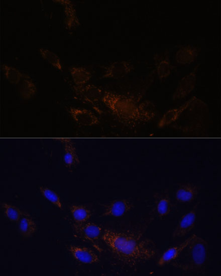 Immunofluorescence analysis of C6 cells using PSMB7 Polyclonal Antibody at dilution of  1:100 (40x lens). Blue: DAPI for nuclear staining.