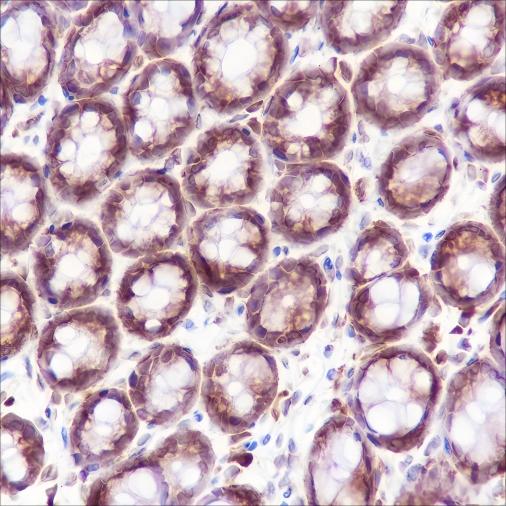 Recombinant Bid Monoclonal Antibody - small - 4