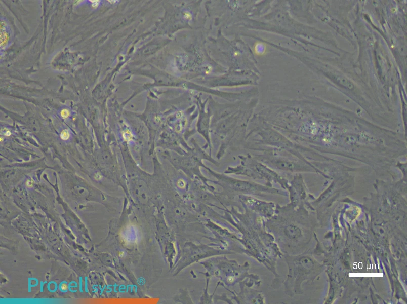 Mouse Mammary Fibroblast Complete Medium - 6