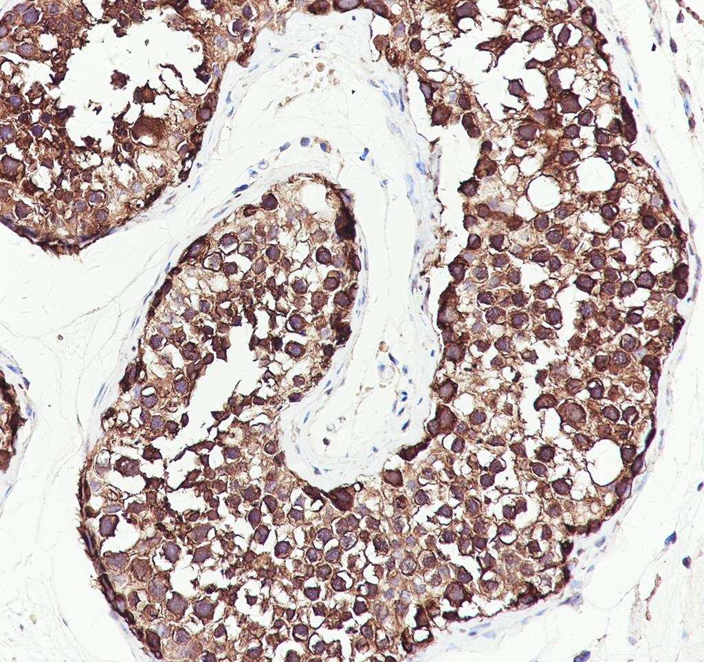 Recombinant PRDM4/PFM1 Monoclonal Antibody - small - 4