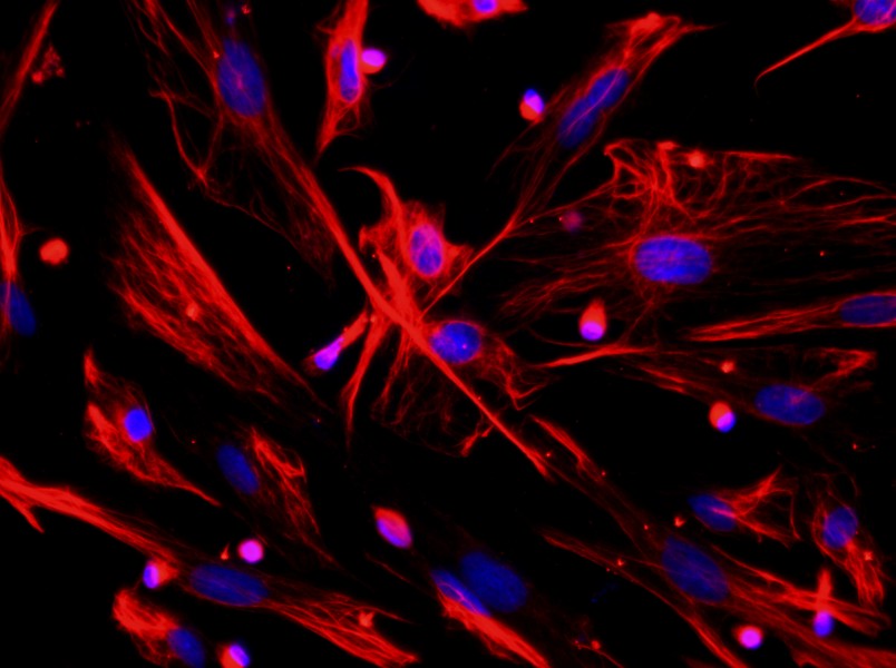 Mouse Dermal Fibroblast Complete MediumMouse Dermal Fibroblast Complete Medium - 2