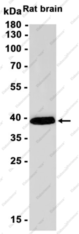 Recombinant SIRT2 Monoclonal Antibody - 1