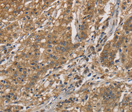 CKMT2 Polyclonal Antibody - 2