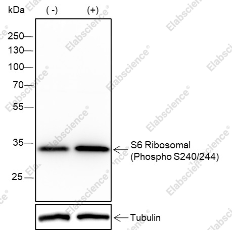 Recombinant Phospho-S6 Ribosomal Protein (Ser240, 244) Monoclonal Antibody - 1