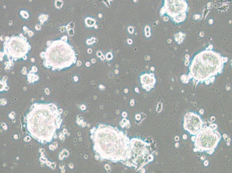 SK-ES-1 Cell Complete Medium - small - 5