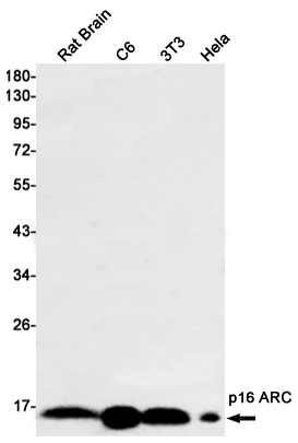 Western blot detection of p16 ARC in Rat Brain,C6,3T3,Hela cell lysates using p16 ARC Rabbit mAb(1:1000 diluted).Predicted band size:16kDa.Observed band size:16kDa.