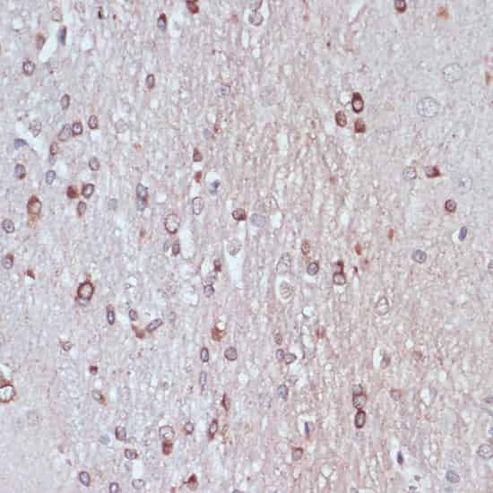 Immunohistochemistry of paraffin-embedded Rat brain using TPD52 Polyclonal Antibody at dilution of 1:100 (40x lens).
