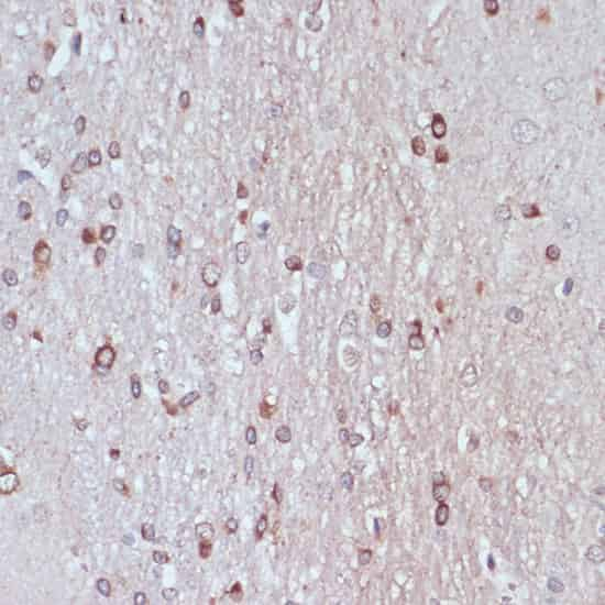 Immunohistochemistry of paraffin-embedded Rat brain using TPD52 Polyclonal Antibody at dilution of  1:100 (40x lens).