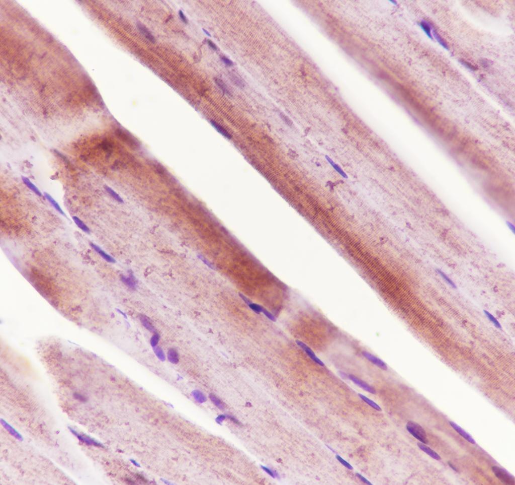 Recombinant Ryanodine Receptor Monoclonal Antibody - small - 4