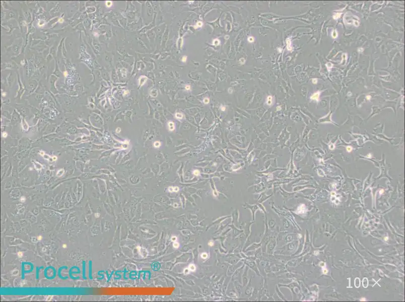 NCI-H1568 [H1568] Cell Complete Medium - 1